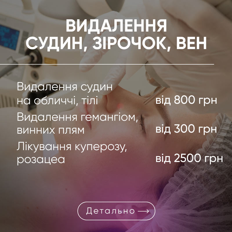 акція