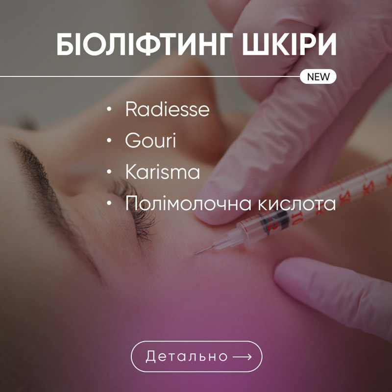акція