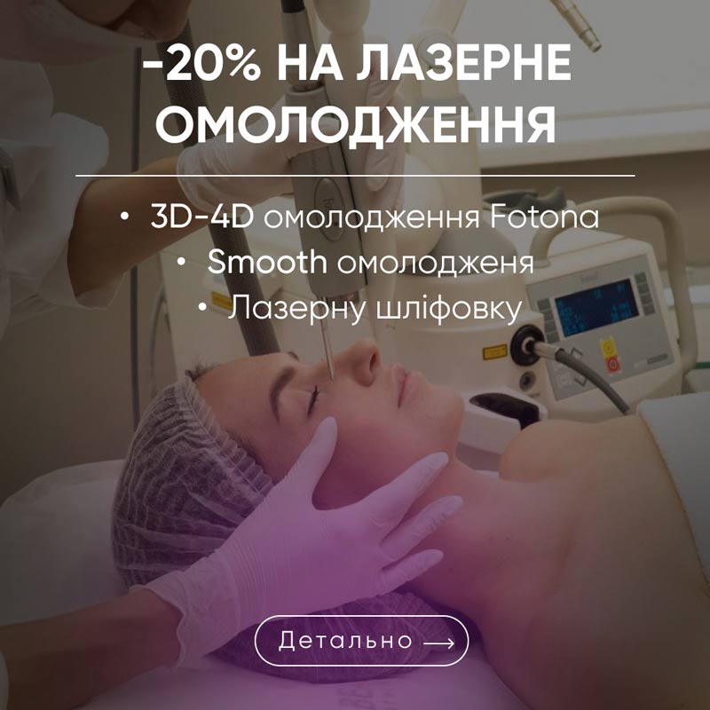 акція