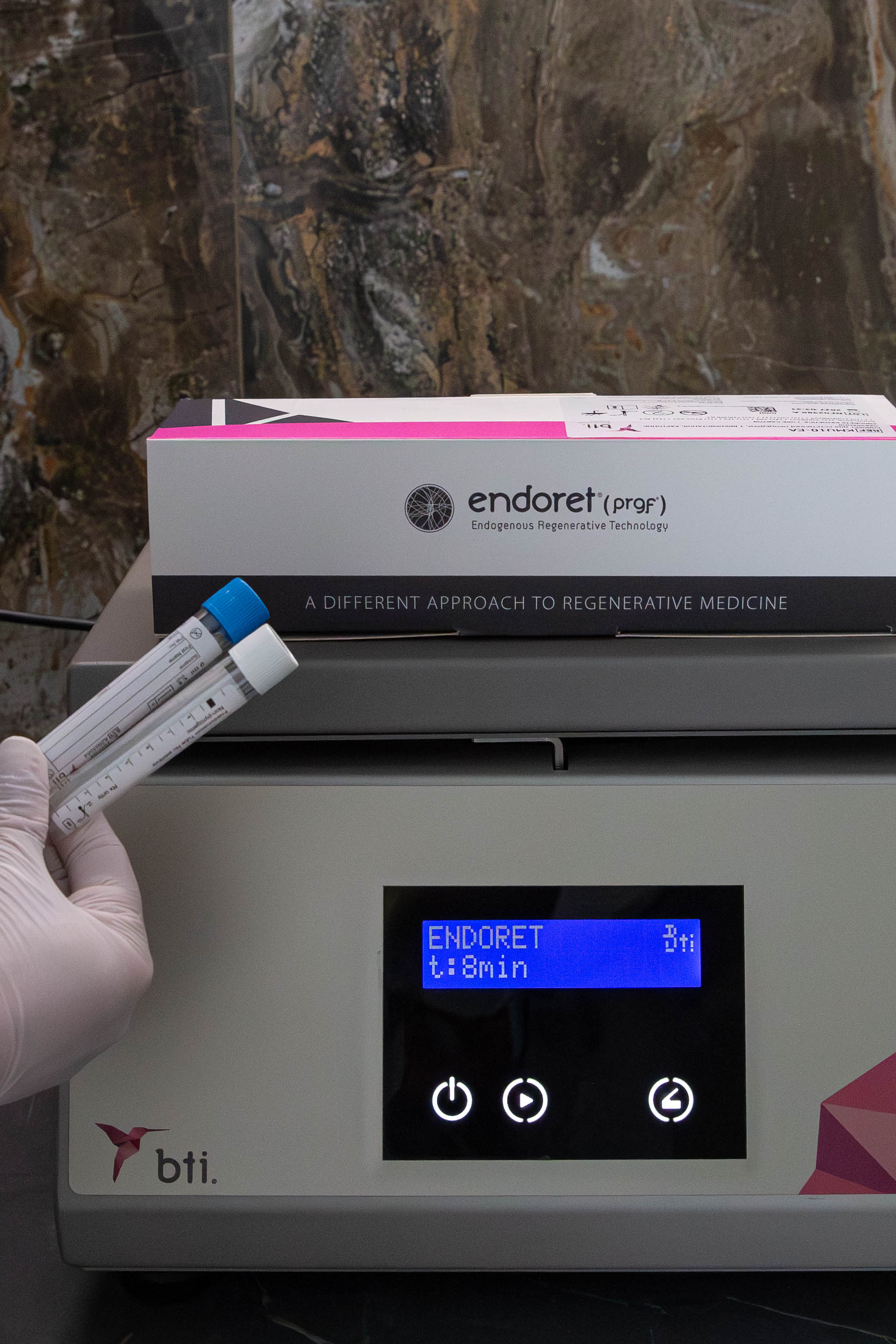 плазмолифтинг prgf endoret
