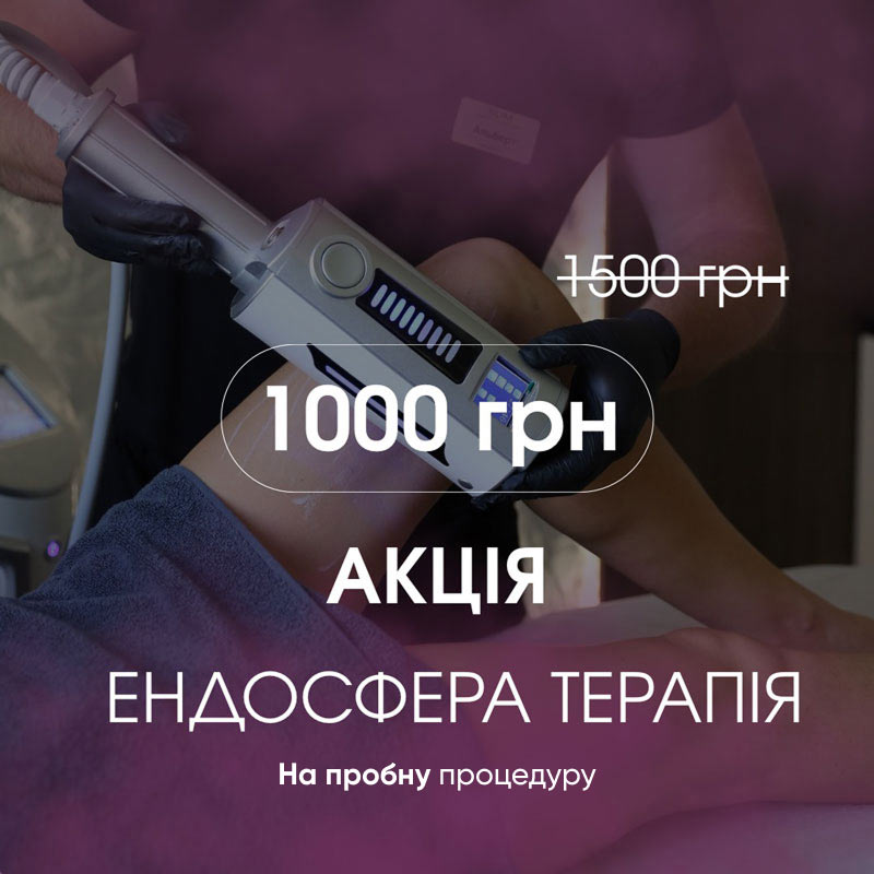 акція