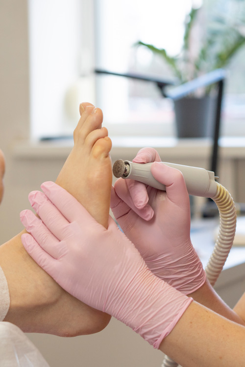 medizinskiy pedicur
